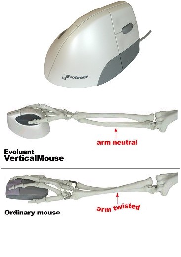 Mouse Arm Position