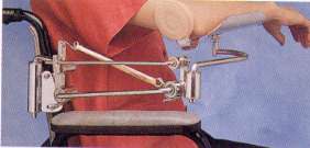 Elevating Proximal Arm MAS Kit